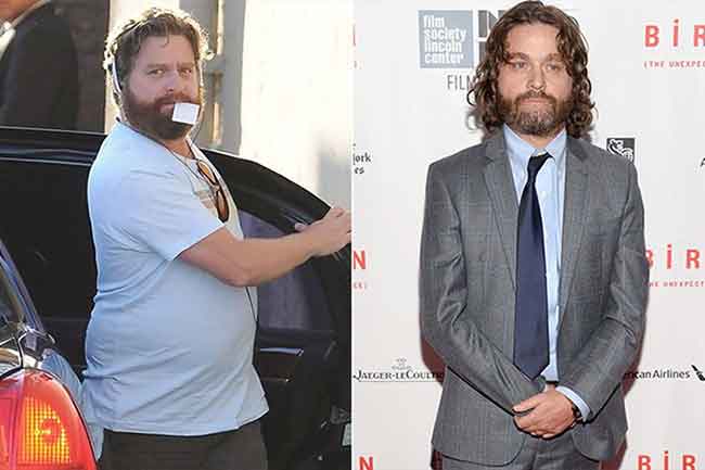 zach galifianakis skinny