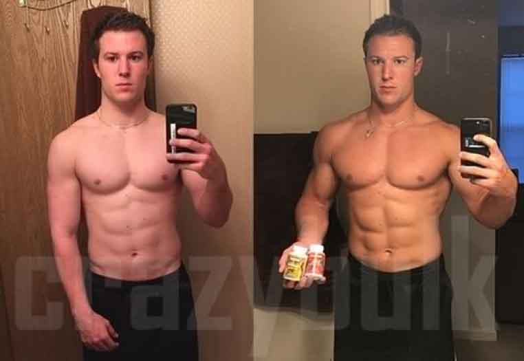 Before and After 2