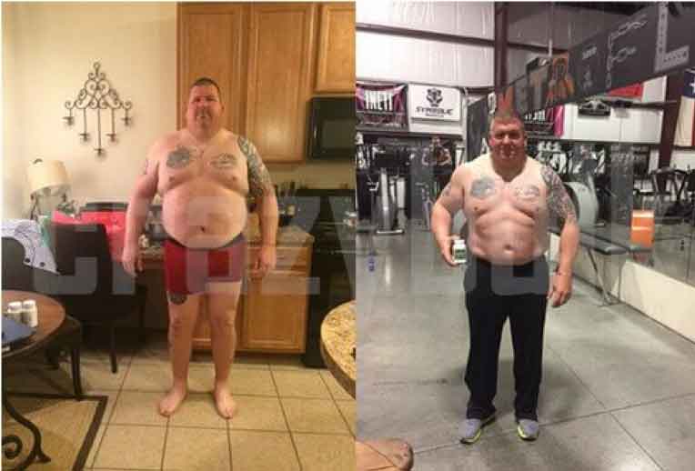 Richard before and after