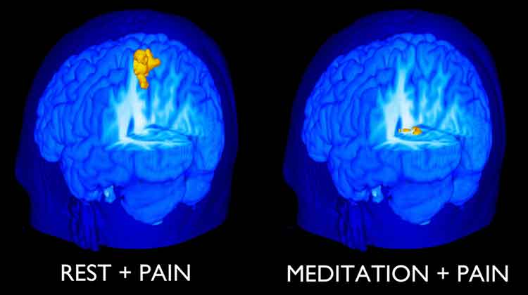 Pain and meditation