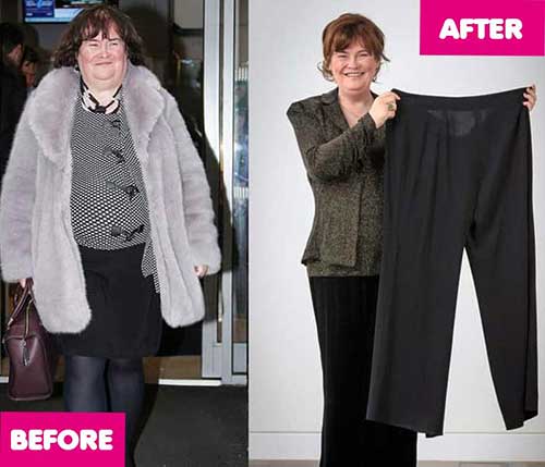 Susan Boyle before after