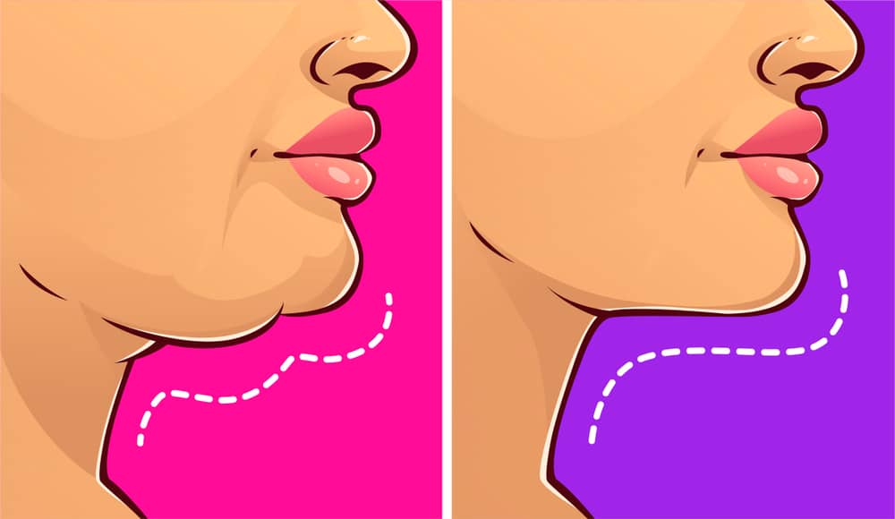 get rid of fat under chin