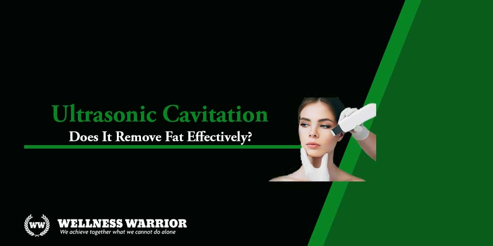 Does Ultrasonic Cavitation Remove Fat Effectively?