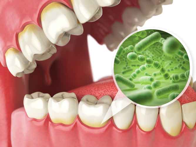 Cavity