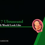 ultrasound week 7