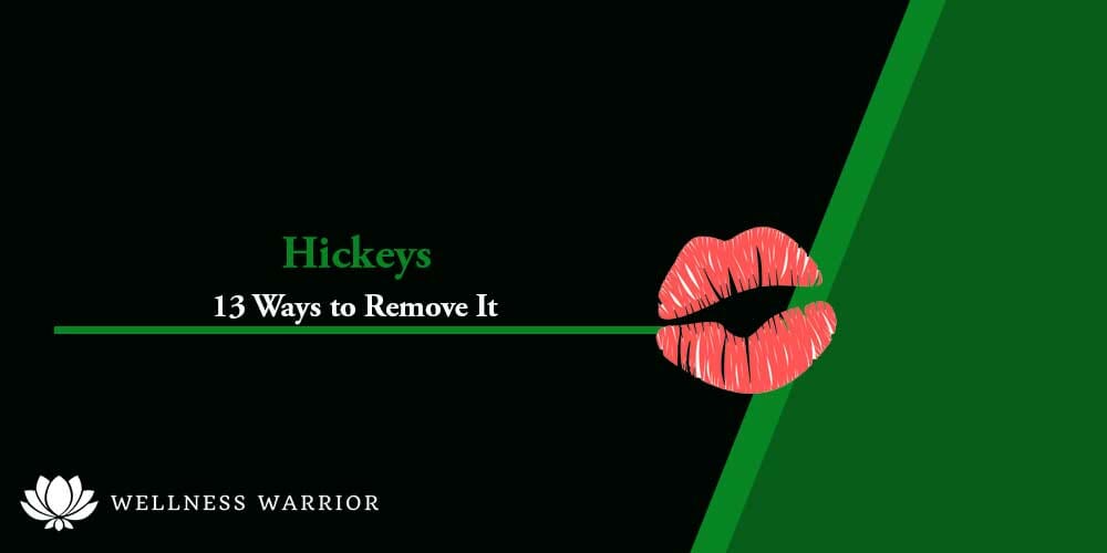 how to get rid of a hickey fast