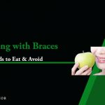 foods you can and can't eat with braces