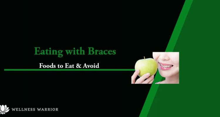 foods you can and can't eat with braces
