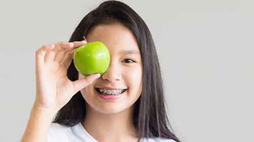 girl with braces holding apple