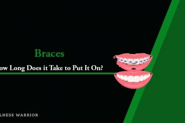 how long does it take to put on braces
