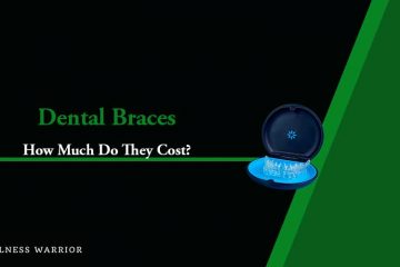 how much do braces cost