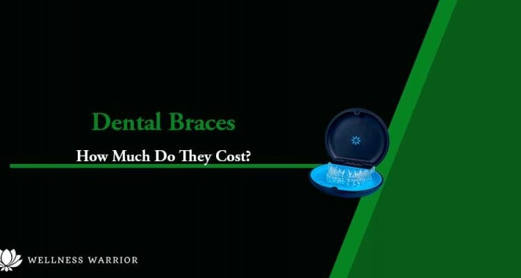 how much do braces cost
