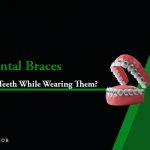 how to whiten teethn with braces